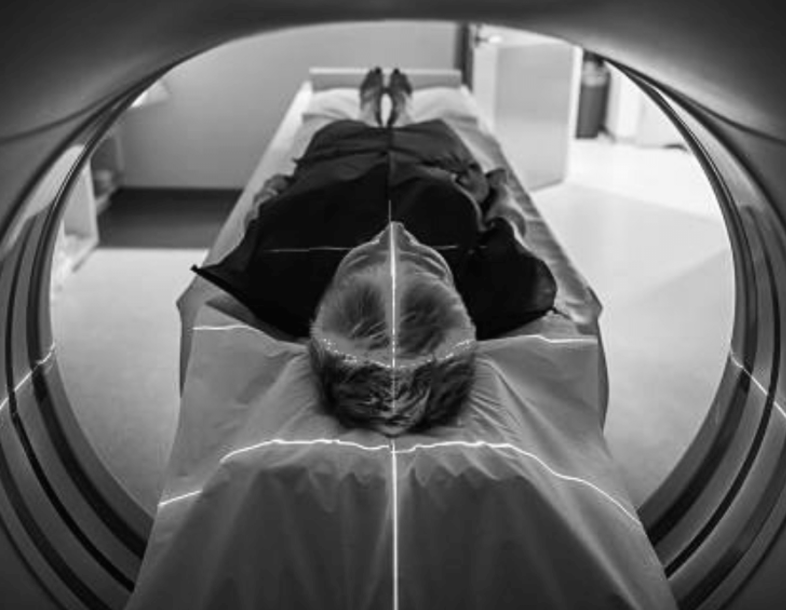MRI